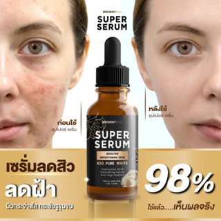 พร้อมส่ง แท้100% ซุปเปอร์ เซรั่ม SUPER SERUM X50 PURE WHITE ลดริ้วรอย สิว ฝ้า กระ จุดด่างดำ บำรุงผิวใส สว่าง ขนาด30ml