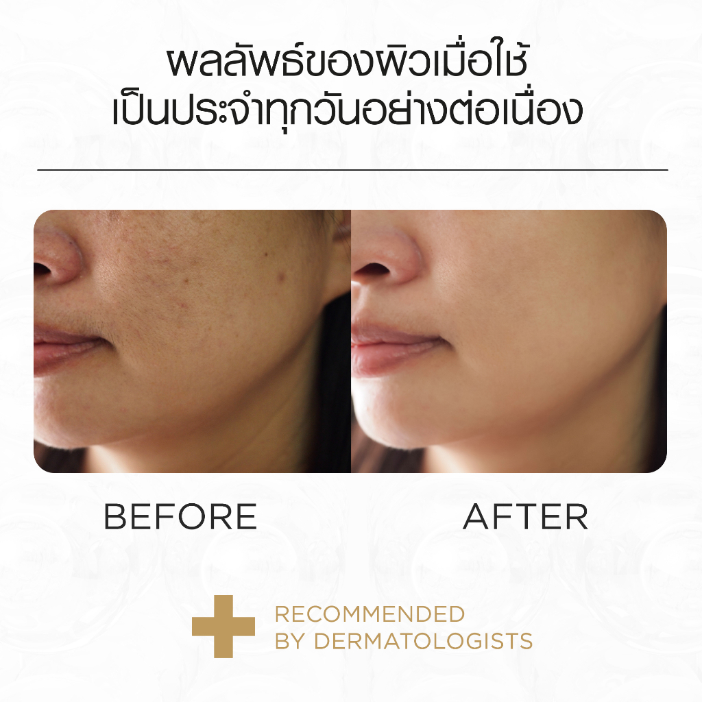 smooth-e-gold-miracle-capsule-12s-แคปซูลเซรั่ม-กระชับรูขุมขน-ผิวหน้ากระจ่างใส-จุดด่างดำดูจางลง