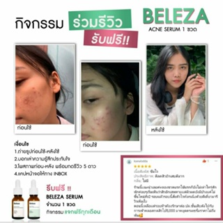 Beleza Skin Whitening&amp;Acne Serum 15 ml