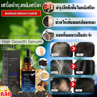 เซรั่มบำรุงหนังศรีษะ ปลูกเส้นผม Bunee hair growth Serum ดูแลรากผม ช่วยให้ผมหนาขึ้น ลดการหลุดล่วงของเส้นผม ขนาด60ml