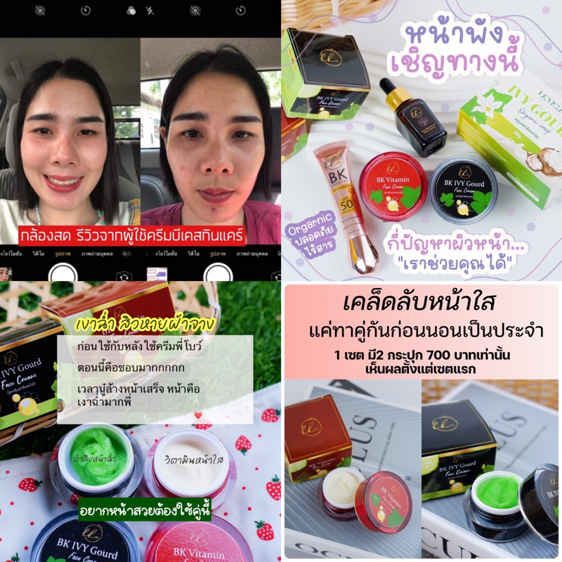 ครีมตำลึงลอกฝ้ากระเห็นผล7วัน-ส่งฟรี-ลอกฝ้า-หน้าขาวสิวยุบ