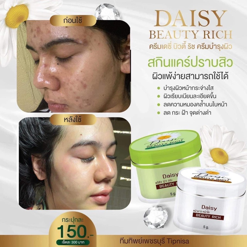 ครีมเดซี่-daisy-เดซี่-ครีมdaisy-ครีมทากลางวัน-ครีมทากลางคืน