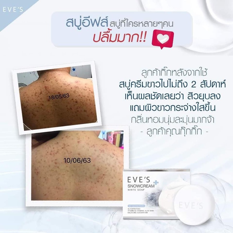 eves-สบู่ครีมขาว-อีฟส์-สโนว์ครีม-ไวท์-โซฟ-สบู่ผิวขาว-สบู่ลดสิว-ผิวกาย-สิวที่หลัง-สบู่ฟอกตัวขาว-รักษาสิว-สบู่อาบน้ำ-ครีม