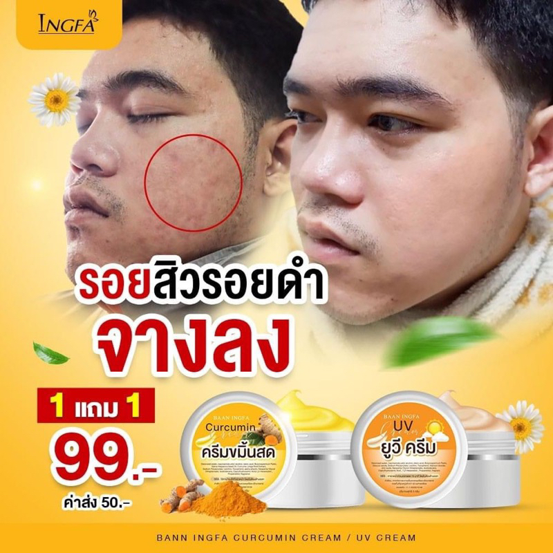 ของเเท้-พร้อมส่ง-ครีมขมิ้นสด-อิงฟ้า-รักษาสิว-สลายฝ้า-หน้าเด้ง