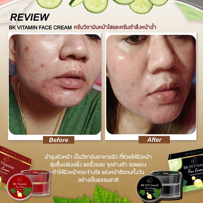 ครีมตำลึงลอกฝ้ากระเห็นผล7วัน-ส่งฟรี-ลอกฝ้า-หน้าขาวสิวยุบ