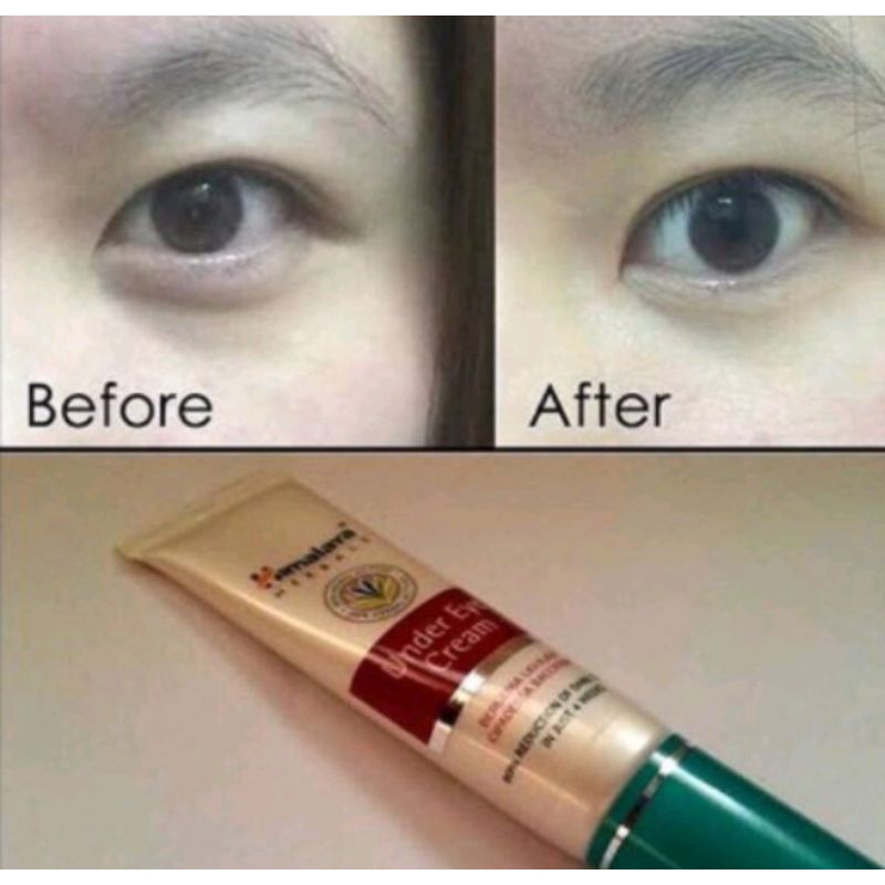 himalaya-herbals-under-eye-creamลดรอยหมองคล้ำ-บำรุงใต้ตา