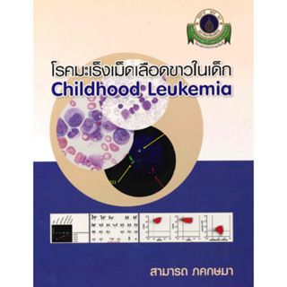 c111 โรคมะเร็งเม็ดเลือดขาวในเด็ก (CHILDHOOD LEUKEMIA) 9786162799280