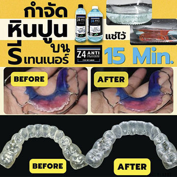น้ำยาทำความสะอาดรีเทนเนอร์-และฟันปลอม-z4-anti-plaque-400ml-พร้อมกล่องแช่รีเทนเนอร์ปกติ-70-มีกล่อง-2-ขนาดโปรดระบุ