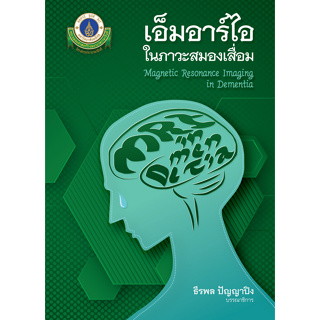 (ศูนย์หนังสือจุฬาฯ) เอ็มอาร์ไอในภาวะสมองเสื่อม (MAGNETIC RESONANCE IMAGING IN DEMENTIA) 9786164437227