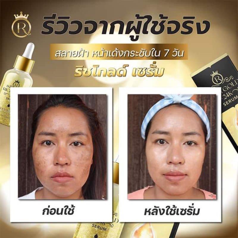 3-ขวด-ของแท้-100-เซรั่มลดฝ้า-สิว-หน้ากระจ่างใสใน-7-วัน-เอส-เพอร์เฟค-เซรั่ม