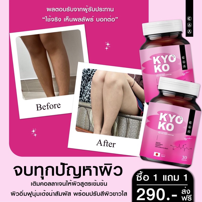 l-ส่งฟรี-1แถม1-กลูต้า-เคียวโก๊ะ-ของแท้-100-แก้ปัญหาผิวหมองคล้ำ-ฝ้า-กระ-จางลง-ผิวขาวใสขึ้นจนเพื่อนทัก