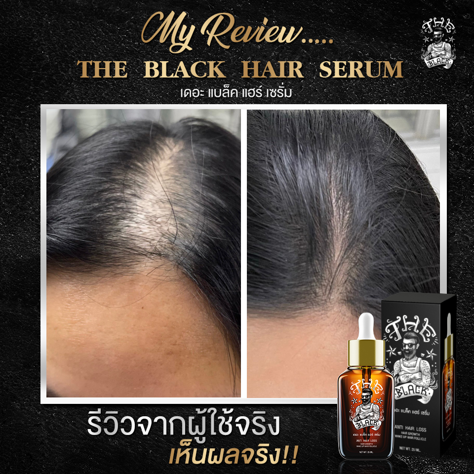 ส่งฟรี-ปลายทาง-ปลูกผม-the-black-เซรั่มปลูกผม-ปลูกคิ้ว-ปลูกหนวด-เซรั่มคิ้วดก-เซรั่มปลูกคิ้ว-ขึ้นถาวร