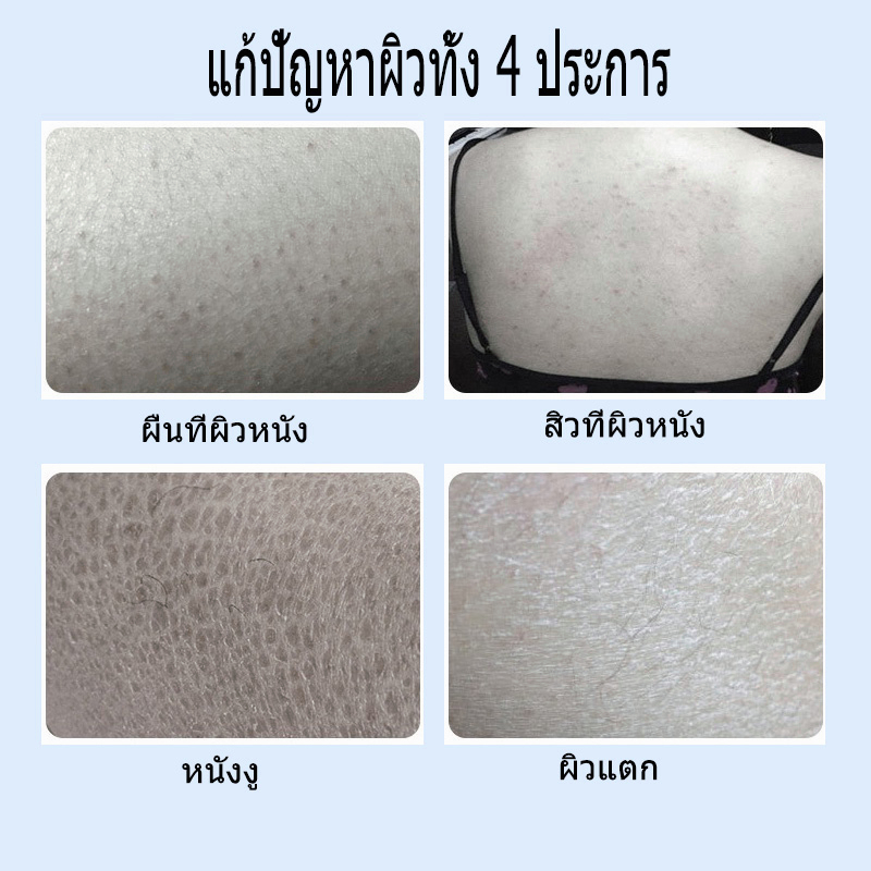 โลชั่นบำรุงผิว-ครีมอาบน้ำ-นมแพะ-ให้ผิวขาวเนียนใส-300ml-ลดผิวหมองคล้ำและผลัดเซลล์ผิว-ครีมอาบน้ำไวท์เทนนิ่ง-ครีมบำรุงผิว