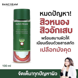 โทนเนอร์มังคุด ลดสิว ฆ่าเชื้อสิว รูขุมขนกระชับ ลดสิวอักเสบ คุมมัน สิวยุบ ACNE SERIES MAGOSTEEN TONER BANCREAM บ้านครีม