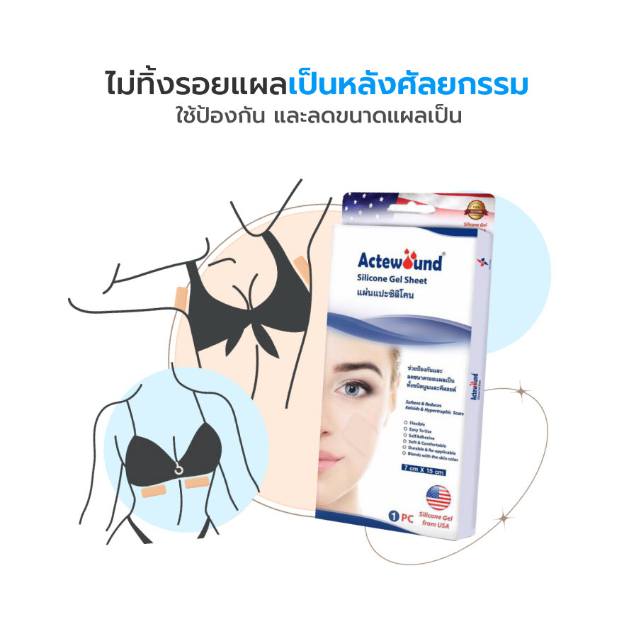 actewound-silicone-gel-sheet-แผ่นแปะซิลิโคน-แผลเป็นนูน-คีลอยด์-ใช้ซ้ำได้