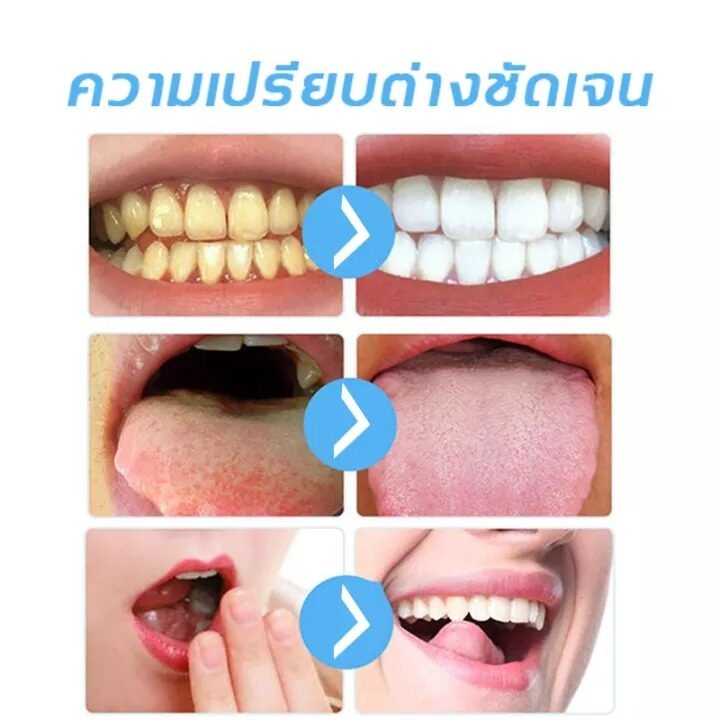 ฟอกฟันขาว-ยาสีฟันฟอกฟันขาว-ดูแลช่องปาก-ปากกาฟอกฟันขาว-แก้กลิ่นปากเหม็น-แก้ฟันเหลือง-เจลฟอกฟันขาว-เหมาะสำหรับทุกคน