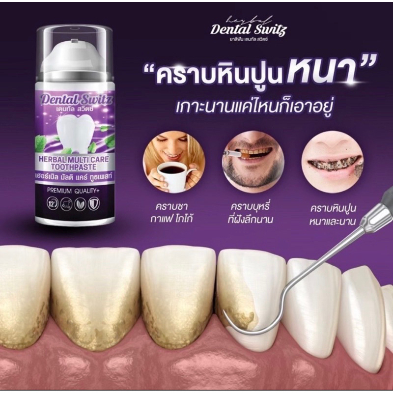 ส่งฟรี-ปลายทาง-เจลฟอกฟันขาว-1แถม1-ราง-dental-switz-ยาสีฟัน-ลดคราบหินปูน-ลดกลิ่นปาก-เจลฟอกฟัน-ลดแบคทีเรีย-ปากหอม