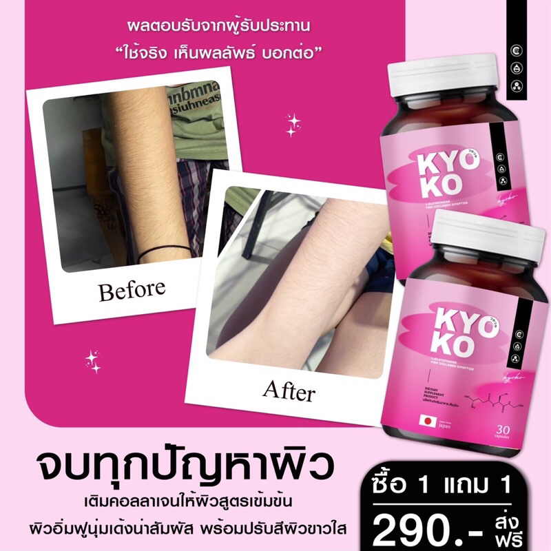 l-ส่งฟรี-1แถม1-กลูต้า-เคียวโก๊ะ-ของแท้-100-แก้ปัญหาผิวหมองคล้ำ-ฝ้า-กระ-จางลง-ผิวขาวใสขึ้นจนเพื่อนทัก