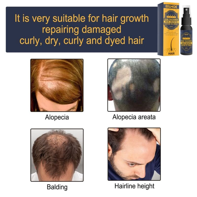 hair-growth-castor-oil-spray-สเปรย์ดูแลหนังศรีษะลดการหลุดล่วงของเส้นผม