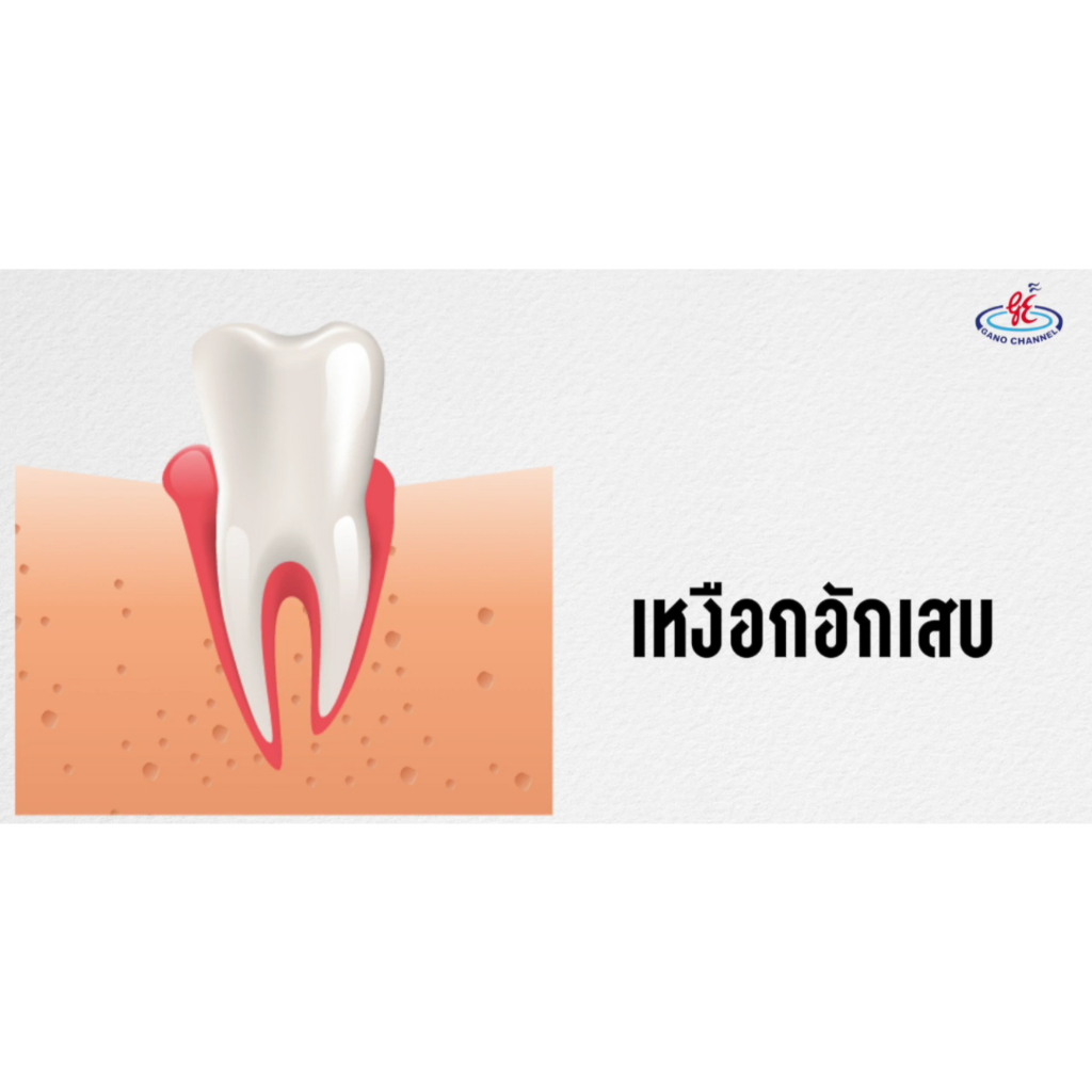 ยาสีฟัน-กาโนเฟร็ช-ผสมเห็ดหลินจือ-gano-fresh-ยาสีฟันกาโน