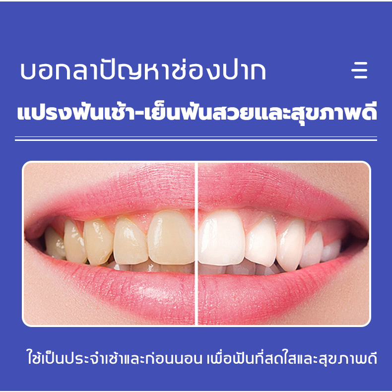 ฟอกฟันขาว-ยาสีฟันฟอกฟันขาว-ดูแลช่องปาก-ปากกาฟอกฟันขาว-แก้กลิ่นปากเหม็น-แก้ฟันเหลือง-เจลฟอกฟันขาว-เหมาะสำหรับทุกคน