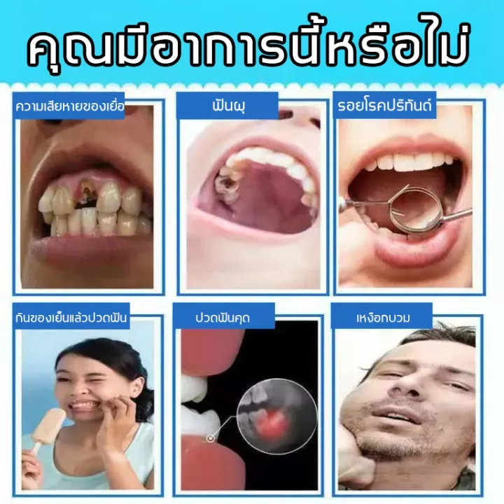 บรรเทาอาการปวด1วินาที-south-moon-สเปรย์แก้ปวดฟัน-20ml-เหงือกบวม-ยาเเก้ปวดฟัน-สเปรย์ฉีดฟัน-ยาแก้ปวดฟัน-ยาฉีดฟัน-ยาปวดฟัน