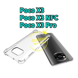✨พร้​อมส่งใน🇹🇭✨เคสใสกันกระแทก Poco X3 Pro / Poco X3 NFC / Poco X3Pro / Poco F2 Pro / Poco F2Pro