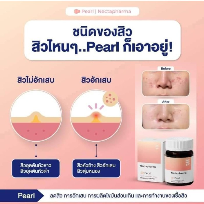 ของแท้-nectapharma-pearl-30เม็ด-วิตามินลดสิว-เนคตาฟาร์มา-สูตรใหม่-ลดการอักเสบ-ลดความมัน-ลดเชื้อสิว-สิวฮอร์โมน