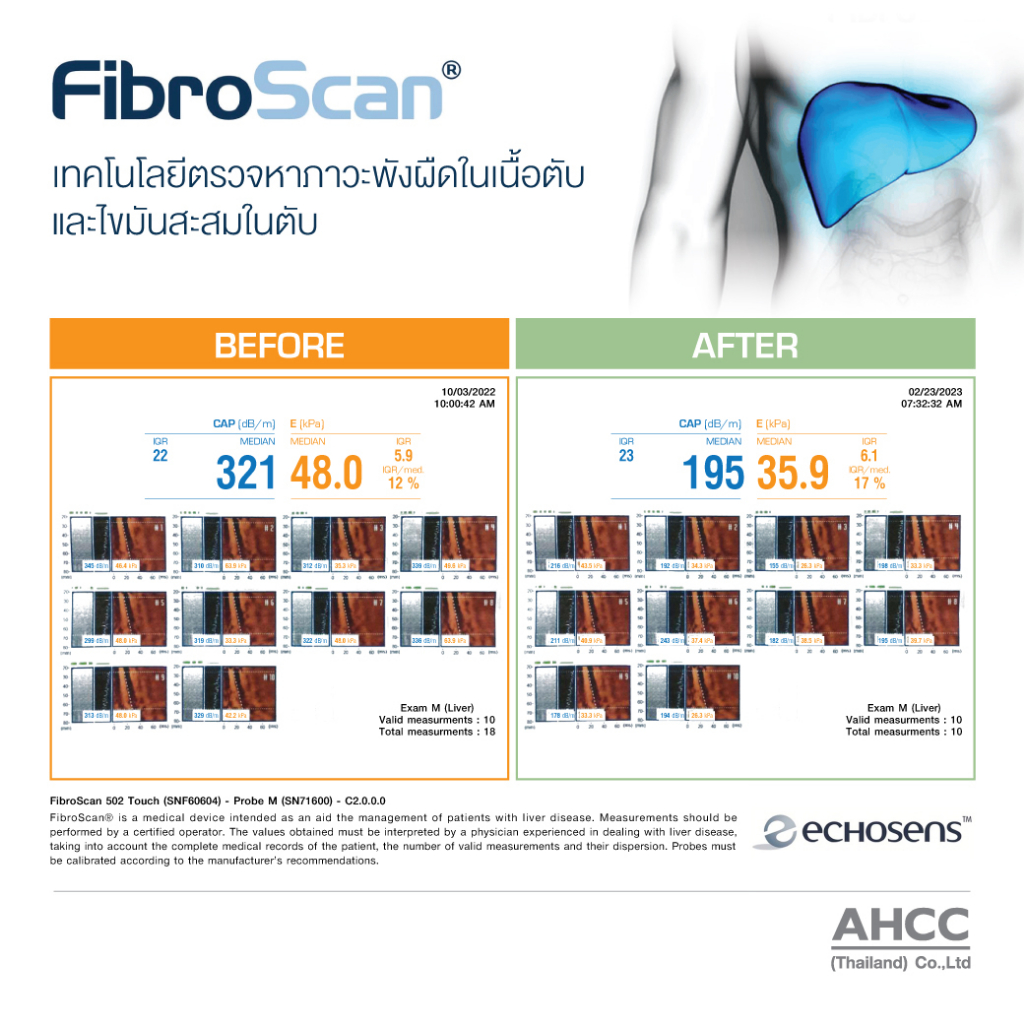 แพ็ค-2-กล่อง-oligo-max-ชะลอวัย-ลดไขมันในช่องท้อง-ไขมันพอกตับ-เพิ่มการไหลเวียนระบบหัวใจ-และหลอดเลือด