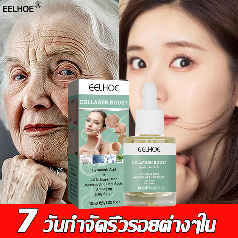 7-วันกําจัดริ้วรอยต่างๆใน-ครีมลดเลือนริ้วรอย-30ml-ครีมยกกระชับ-ครีมต่อต้านริ้วรอย-ครีมลบเลือนริ้วรอย-ครีมริ้วรอย