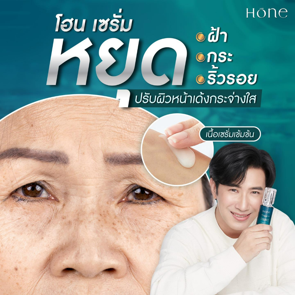 ส่งฟรี-hone-serum-โฮน-เซรั่ม-หนุ่มกรรชัย-ลดริ้วรอย-หน้าเด็ก-หน้าใส-30-ml