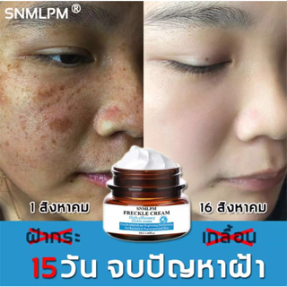 SNMLPM ครีมลดจุดด่างดํา ครีมบำรุงหน้า เซรั่มลดจุดด่างดํา มีประสิทธิภาพลดจุดด่างดำ ฝ้ากระ ยับยั้งการก่อตัวของเมลานิน