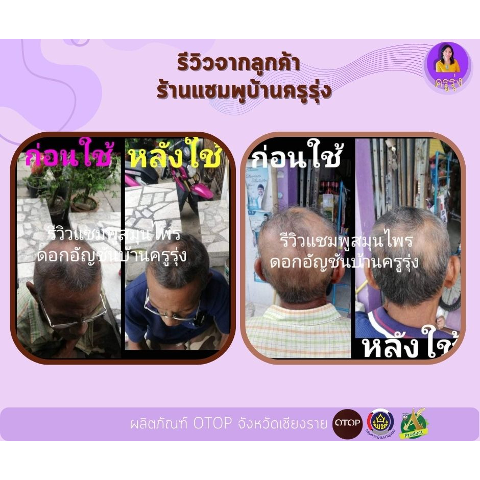 เซรั่มเร่งผมยาวช่วยให้ผมเกิดใหม่-รีฟิล1ขวด