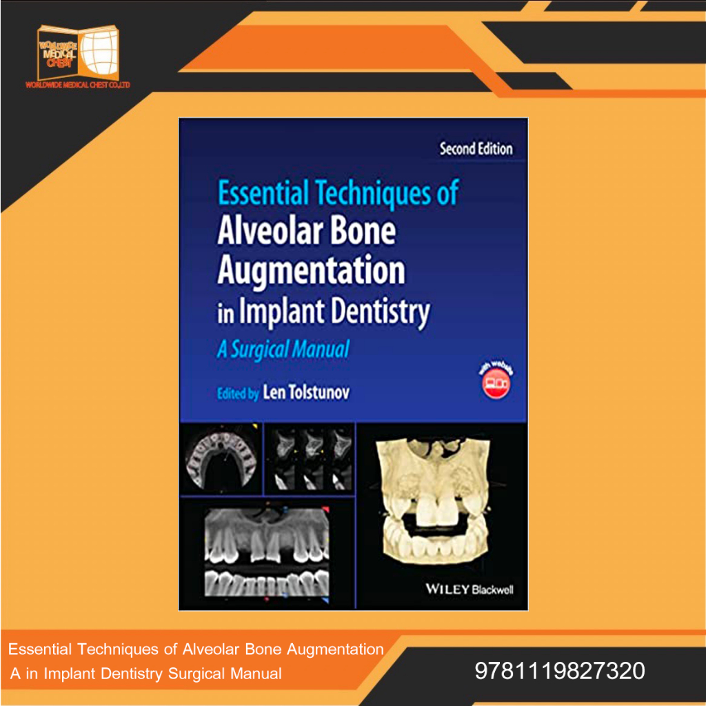 Essential Techniques of Alveolar Bone Augmentation in Implant Dentistry ...