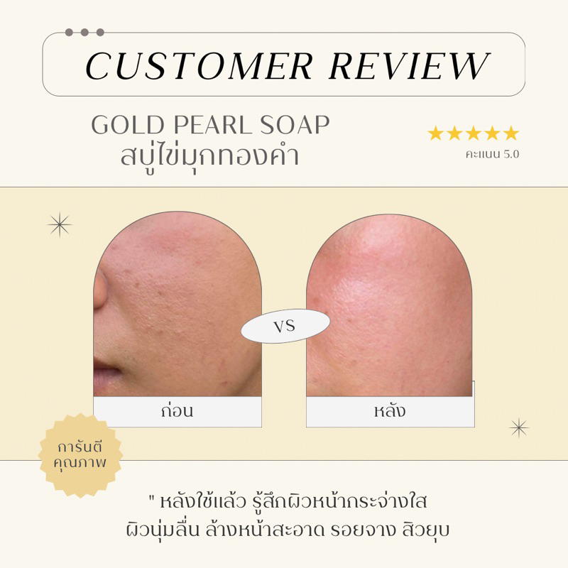 พร้อมส่ง-ลดสิว-สบู่ไข่มุกทองคำ-สบู่หน้าใส