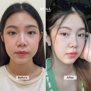 ภาพขนาดย่อของภาพหน้าปกสินค้าMADE Collagen 4 cc 16 จุดทั่วใบหน้า จากร้าน mekobfillclinic บน Shopee