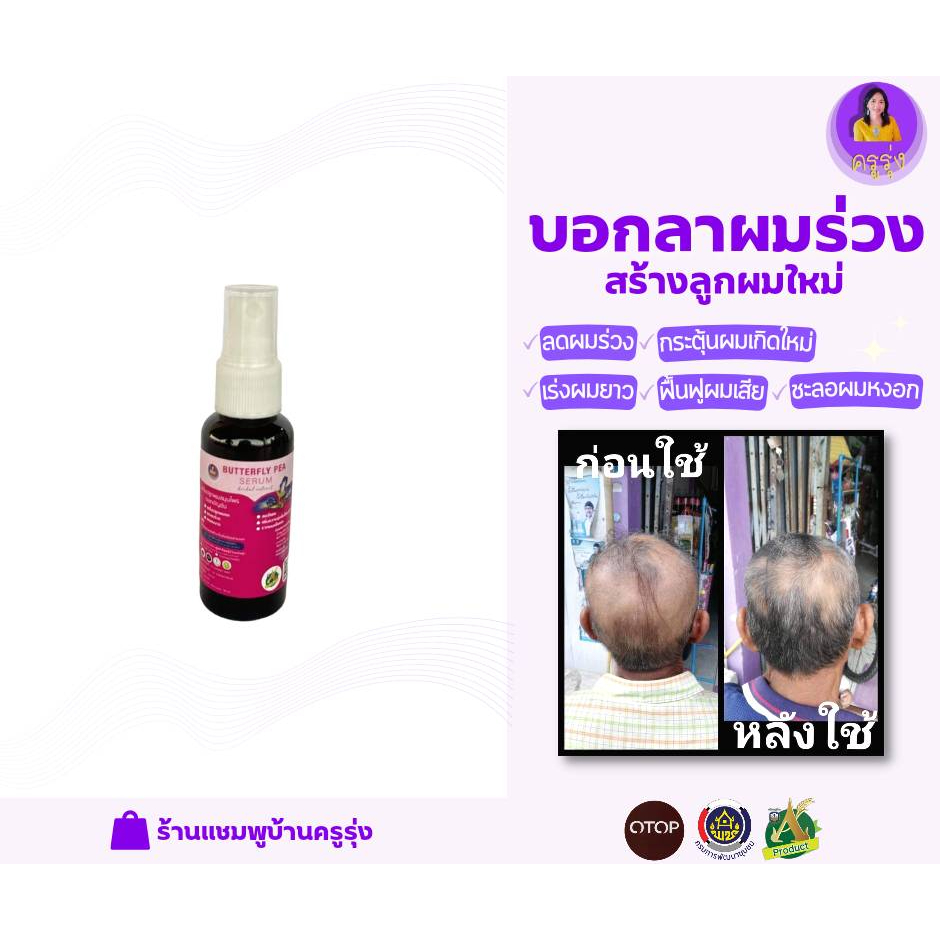 เซรั่มปลูกผม-เซรั่ม-สมุนไพร-ดอกอัญชัน-serum-50ml-1-ขวด-เซรั่มเร่งผมยาว-แก้ปัญหาหัวล้าน-ลดผมบาง-ลดผมร่วง-banorganic