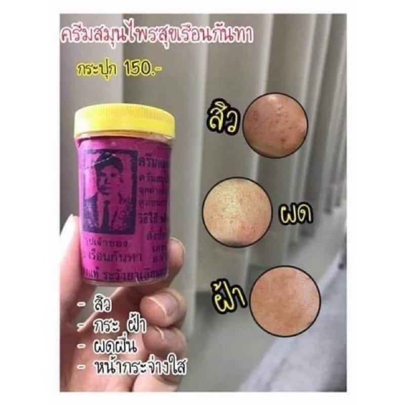 พร้อมส่ง-ครีมสมุนไพรหน้าขาวใส-ลดสิว-ฝ้า-สุขเรือนกันทา