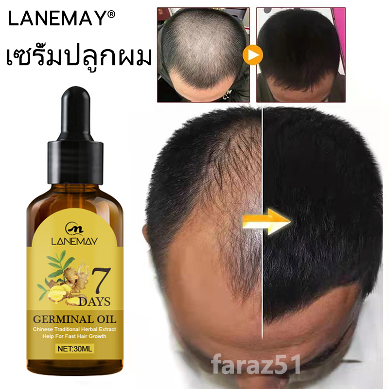 lanemay-เซรั่มปลูกผม-ปลูกผม-บํารุงผม-ป้องกันผมร่วง-ผมบาง-ศีรษะล้าน-30ml-น้ํายาเร่งผมยาว-เซรั่มบํารุงผม-เซรั่มผม