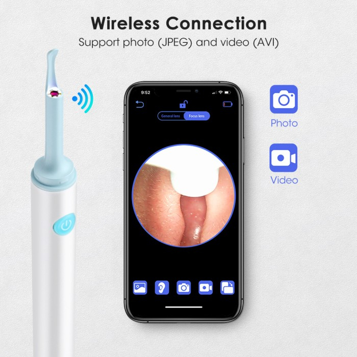 dr-isla-500w-พิกเซล-ear-cleaner-stick-ที่แคะหูมีกล้อง-ไม้แคะหูอัจฉริยะ-การเชื่อมต่อ-wifi-ไม้แคะหู-มี-กล้อง-พร้อมฐานเก็บของ-p3