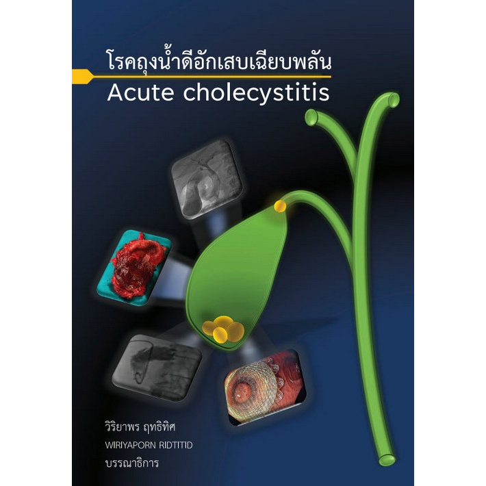 ศูนย์หนังสือจุฬาฯ-9786165885508โรคถุงน้ำดีอักเสบเฉียบพลัน-acute-cholecystitis-c111