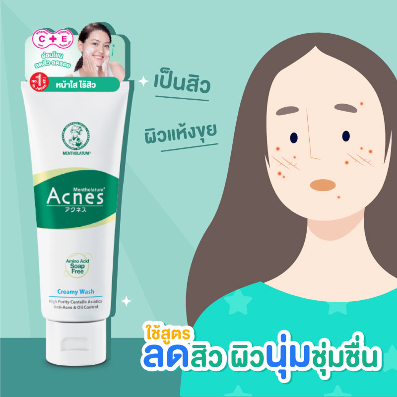 mentholatum-acnes-double-centella-asiatica-creamy-wash-100-g-เมนโทลาทั่ม-แอคเน่ส์-ดับเบิ้ล-เซนเทลล่า-เอเซียติก้า-ครีมมี่-วอช-100-กรัม