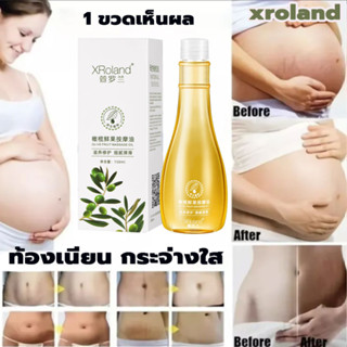 [ ของแท้ / พร้อมส่ง ]ครีมทาแตกลาย ครีมลดรอยแตก XRoland 150ml ลดรอยแตกลาย ครีมทาท้องลาย ครีมทาท้องแตก ครีมลดรอยแตกลาย