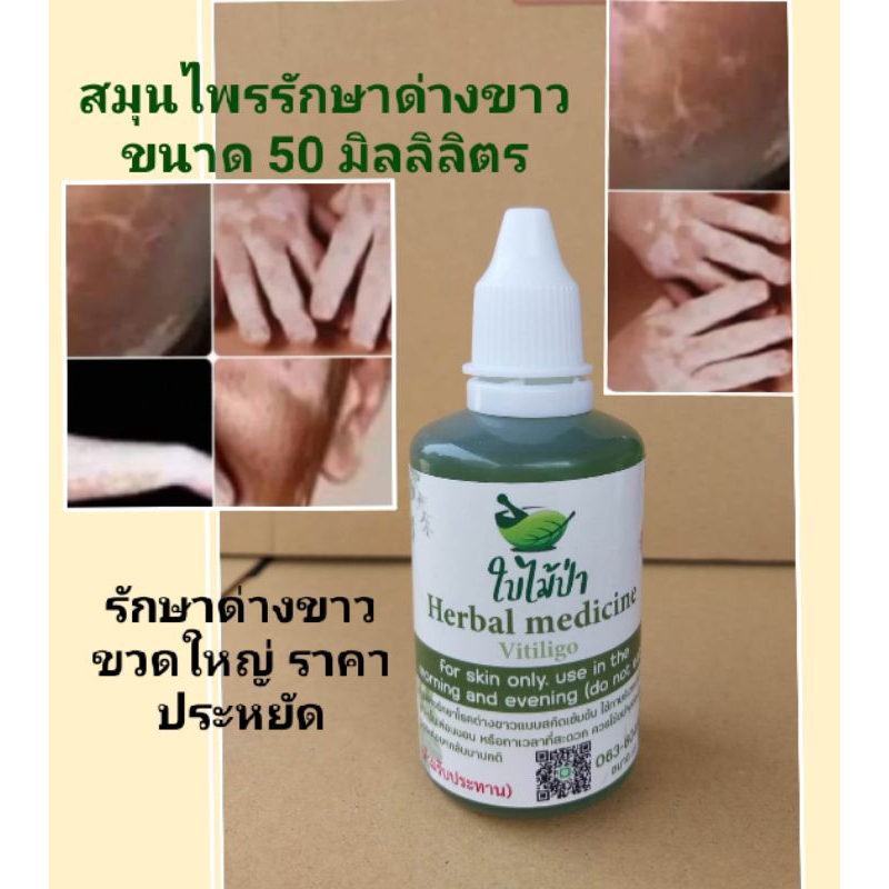 สมุนไพรรักษาด่างขาว50ml-ราคา368