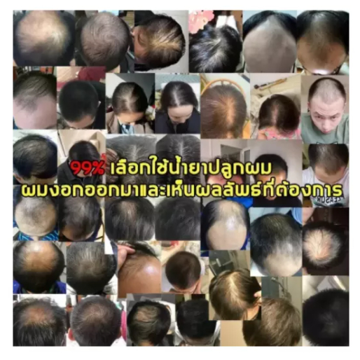 ผงโรยผม-ผงไฟเบอร์ผม-ผงโรยผมหนา-ผงไฟเบอร์ใส่ผม-toppik-สีดำ-ผงไฟเบอร์ปิดผมบาง-ผงไฟเบอร์-ขนาด-27-5-กรัม-สีดำ