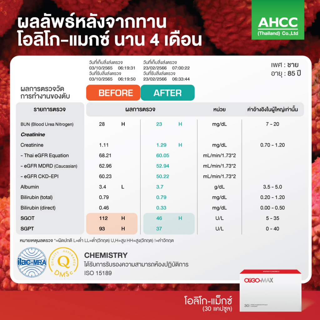 แพ็ค-3-กล่อง-oligo-max-ชะลอวัย-ลดไขมันในช่องท้อง-ไขมันพอกตับ-เพิ่มการไหลเวียนระบบหัวใจ-และหลอดเลือด