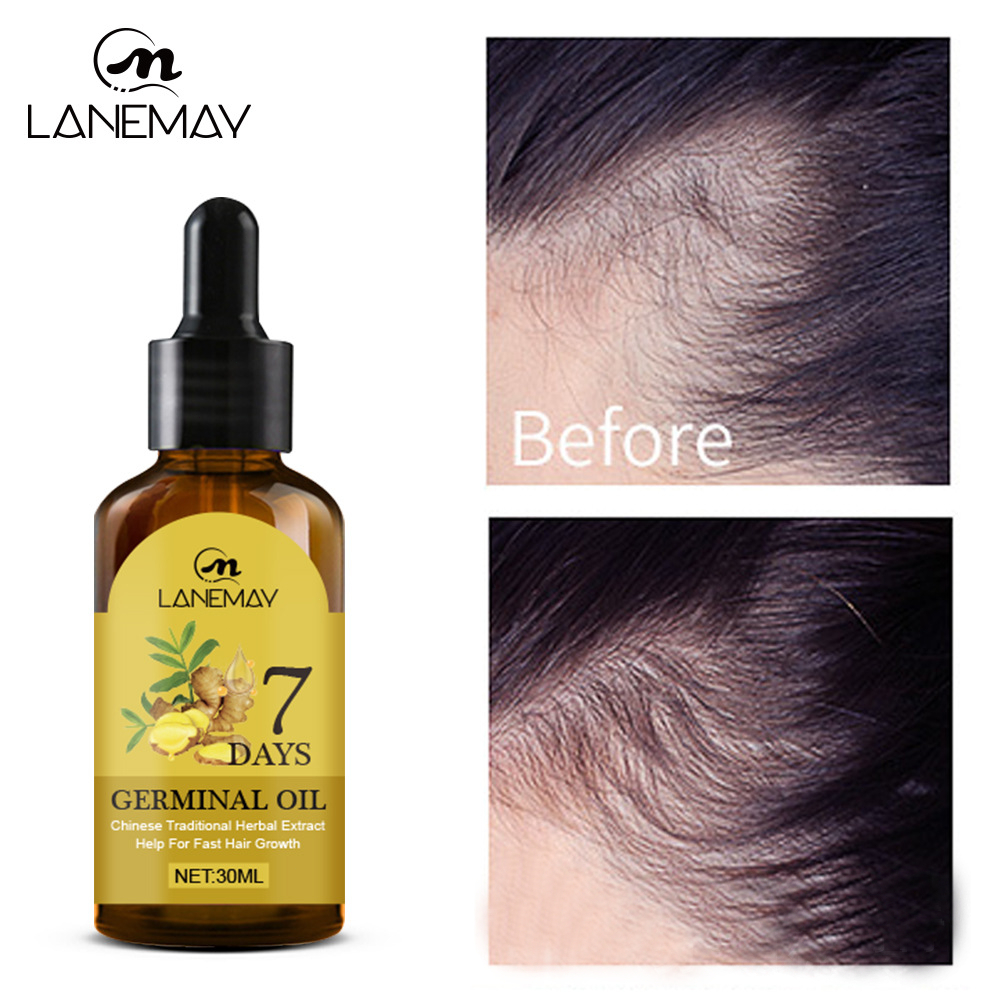 lanemay-เซรั่มปลูกผม-ปลูกผม-บํารุงผม-ป้องกันผมร่วง-ผมบาง-ศีรษะล้าน-30ml-น้ํายาเร่งผมยาว-เซรั่มบํารุงผม-เซรั่มผม
