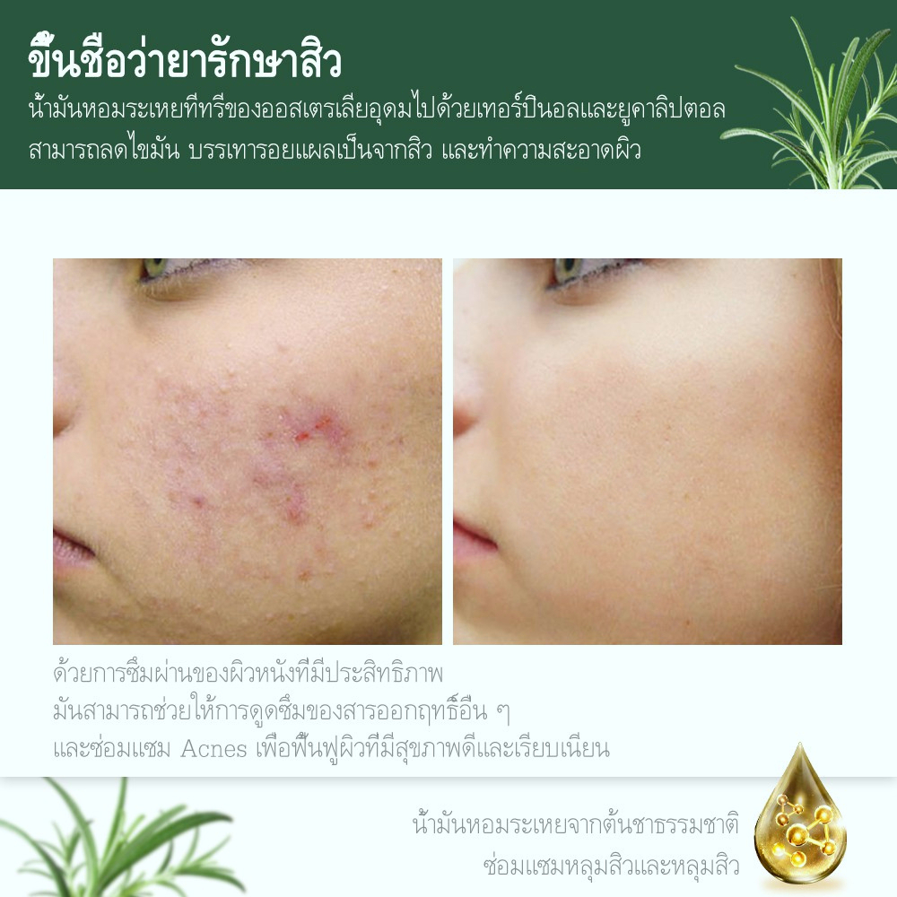 breylee-เจลแต้มสิว-ลบรอยสิว-เจล-fda-ยาลดสิว-ลดรอยสิว-ครีมลดสิว-ครีมลดรอยสิว-ครีมลบรอยสิว-remove-acne-scars