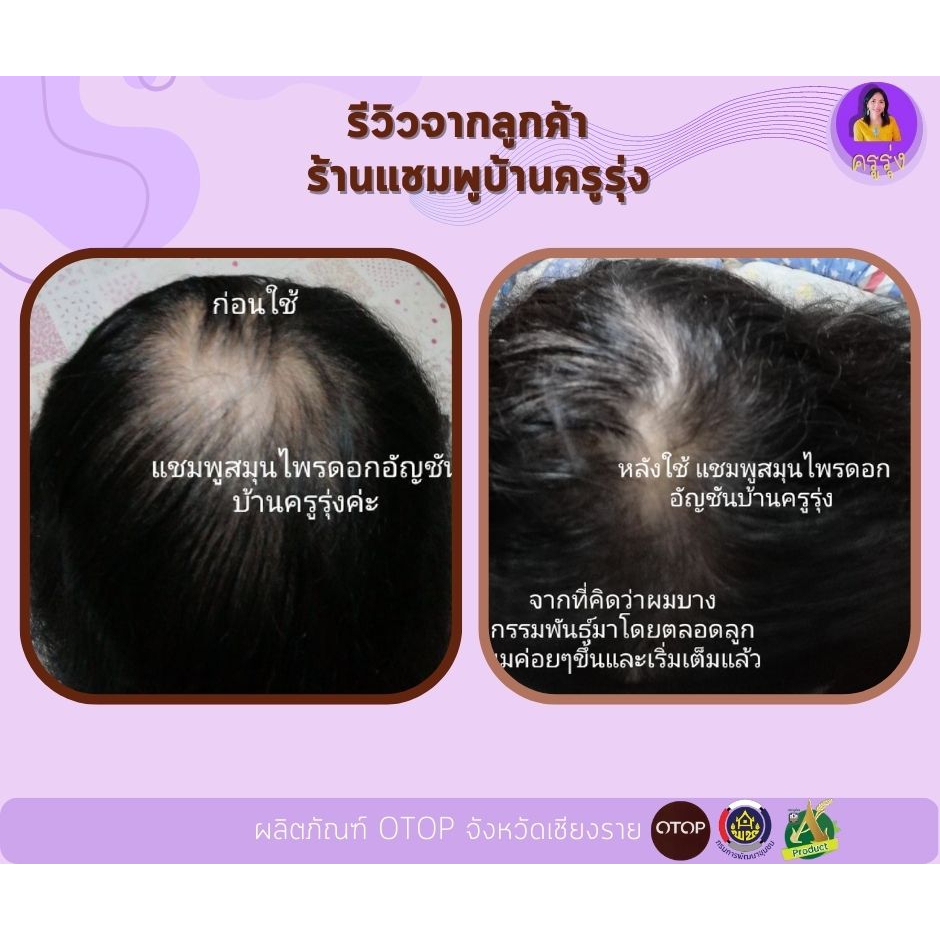 เซรั่มปลูกผม-เซรั่ม-สมุนไพร-ดอกอัญชัน-serum-50ml-1-ขวด-เซรั่มเร่งผมยาว-แก้ปัญหาหัวล้าน-ลดผมบาง-ลดผมร่วง-banorganic