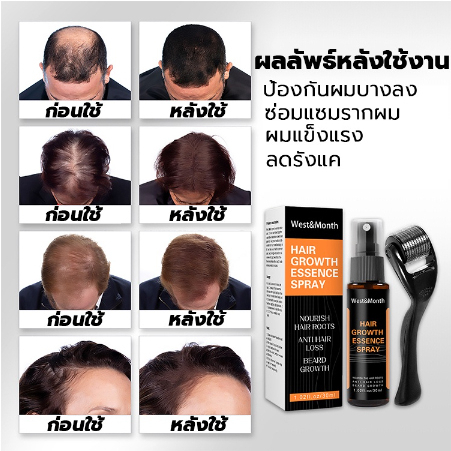 ของแท้100-น้ำยาเร่งผมยาว-เซรั่มปลูกผม-ปลูกผม-สเปรย์ปลูกผม-ปลูกหนวด-น้ํายาเร่งผม-เห็นผลใน30วัน